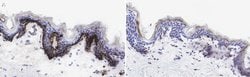COL17A1 Mouse anti-Human, Clone: 123, MilliporeSigma 100 &mu;L; Unconjugated:Antibodies,